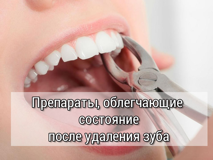 лекарства после удаления зуба
